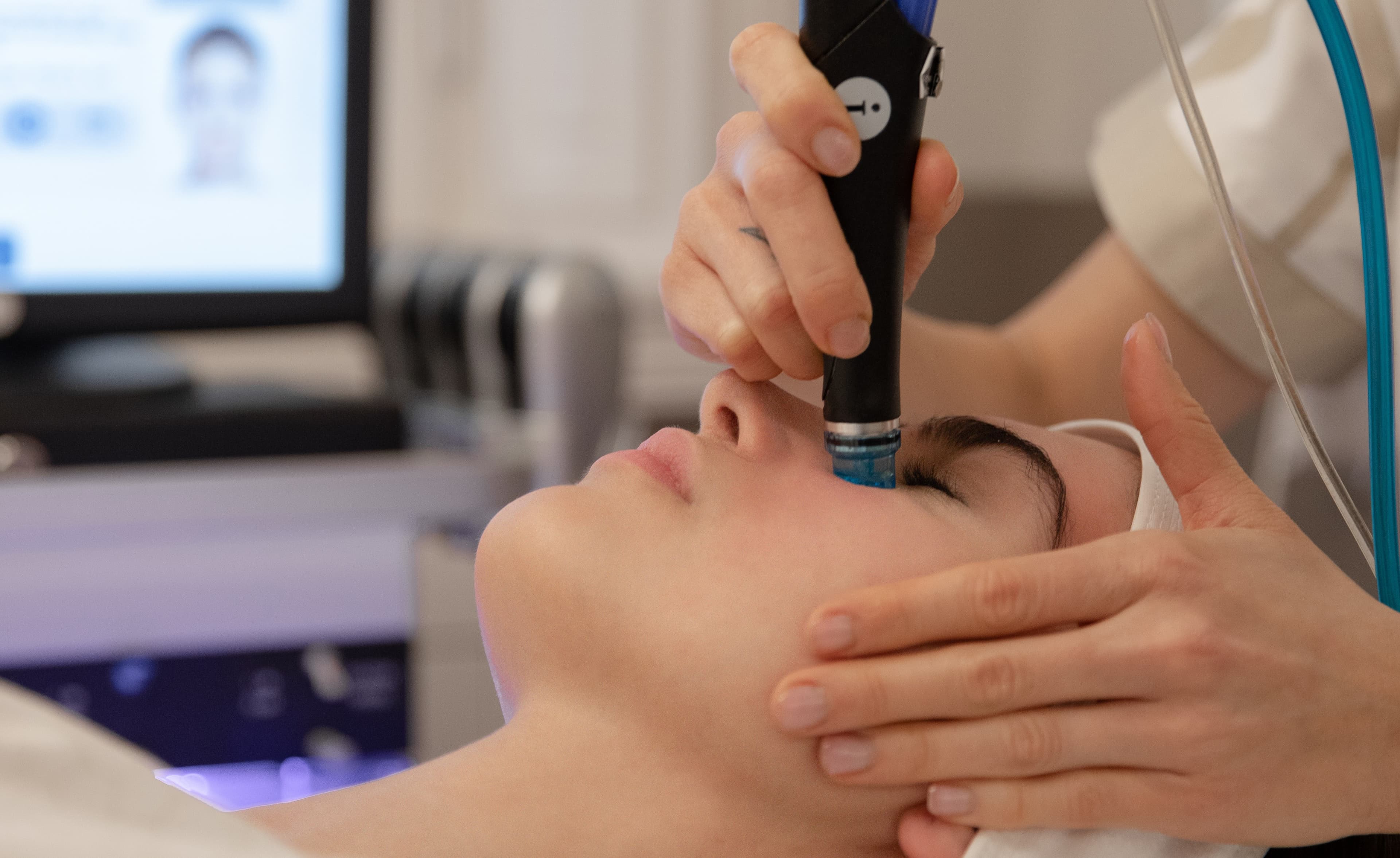 prima-e-dopo-hydrafacial