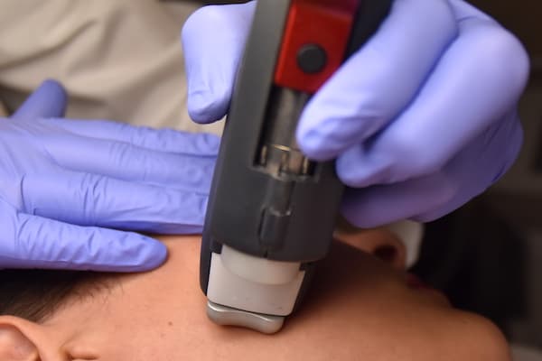 Autumn, Time for Laser Treatments