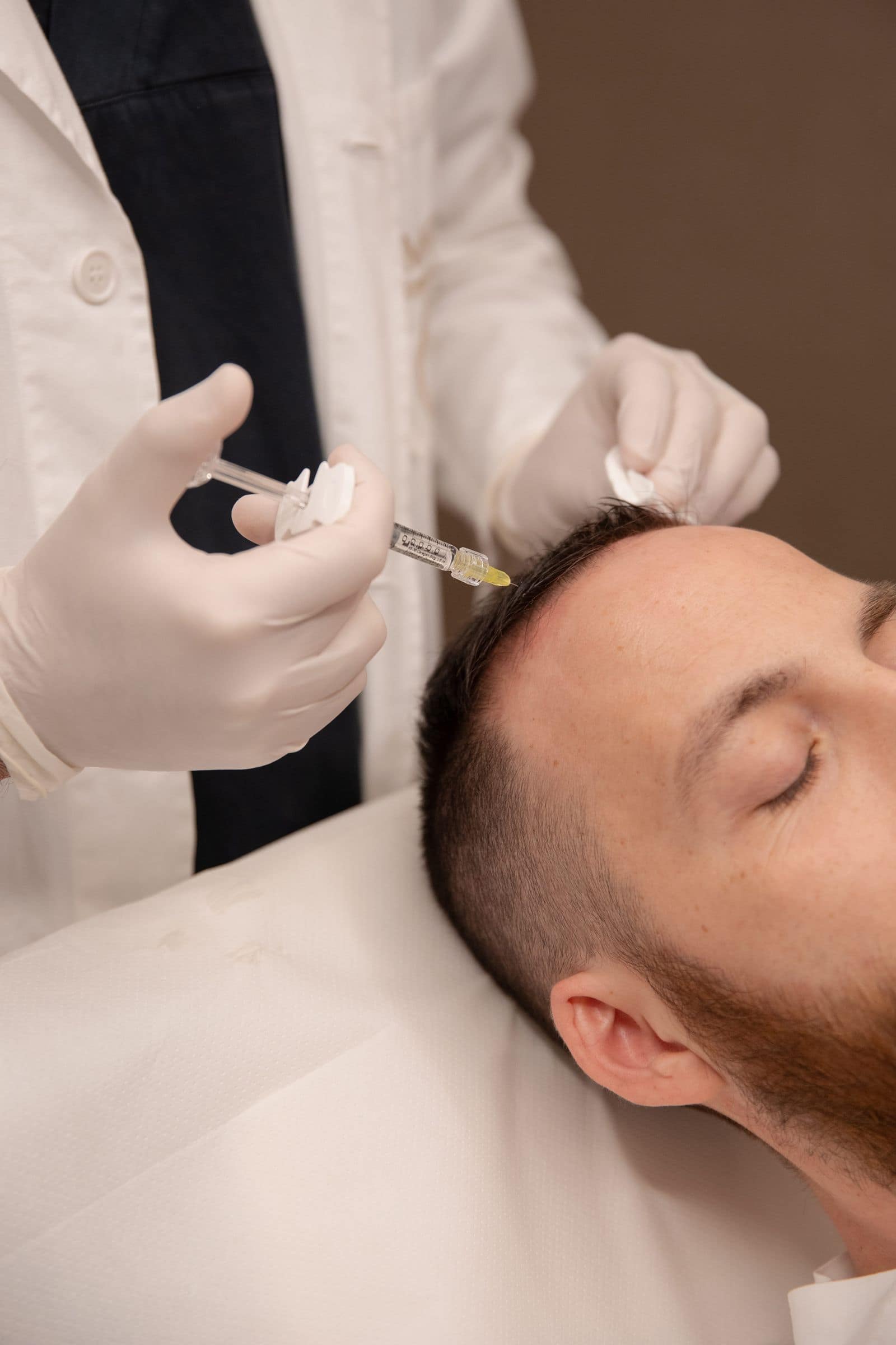 Alopecia e Diradamento: Il Potere del Bulbo Rigenerato