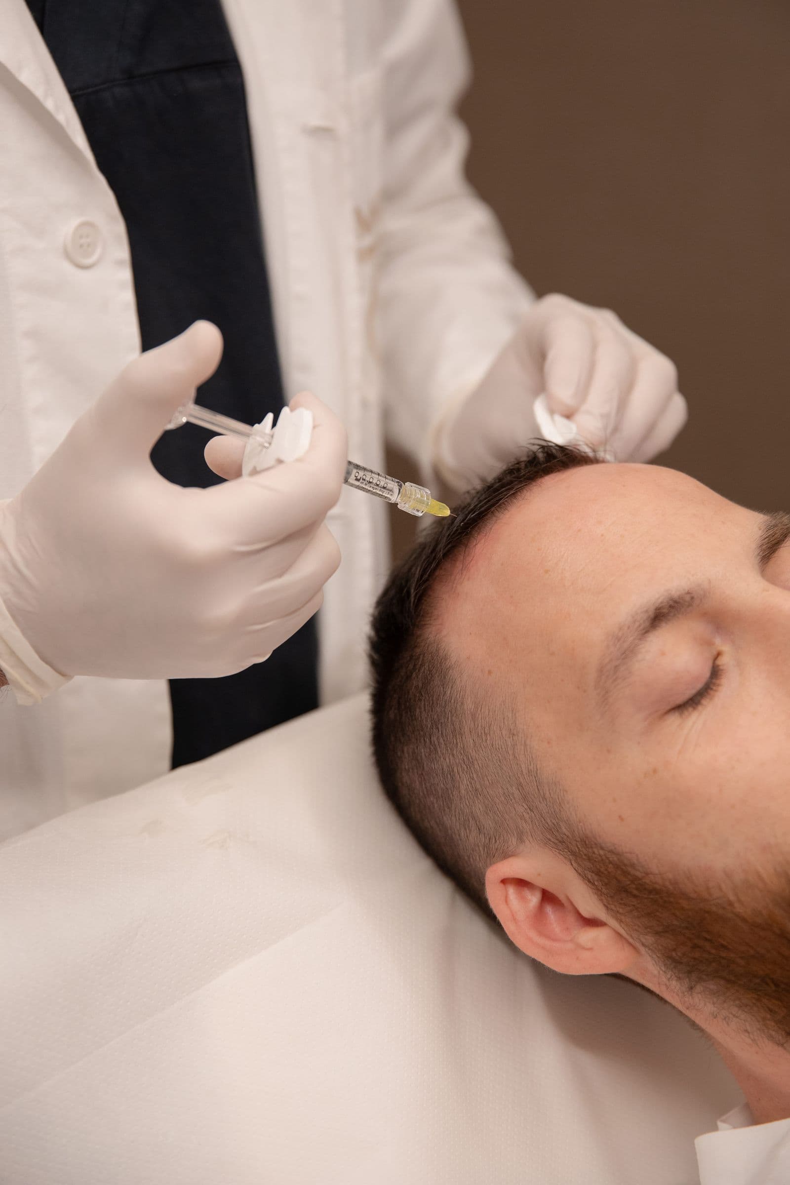 Alopecia e Diradamento: Il Potere del Bulbo Rigenerato