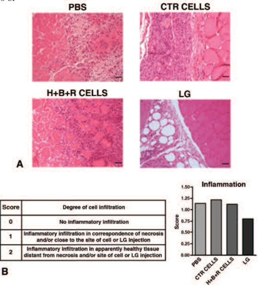 Key visual for lipogems-a-new-modality-of-fat-tissue-handling-to-enhance-tissue-repair-in-chronic-hind-limb-ischemia