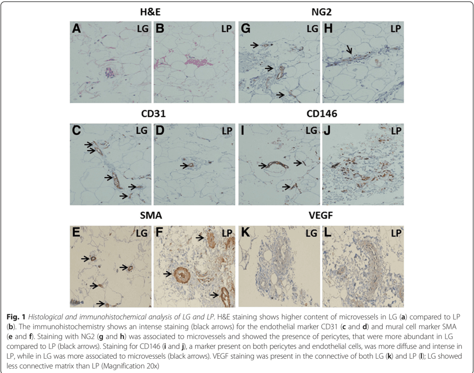 Key visual for angiogenic-and-anti-inflammatory-properties-of-micro-fragmented-fat-tissue-and-its-derived-mesenchymal-stromal-cells