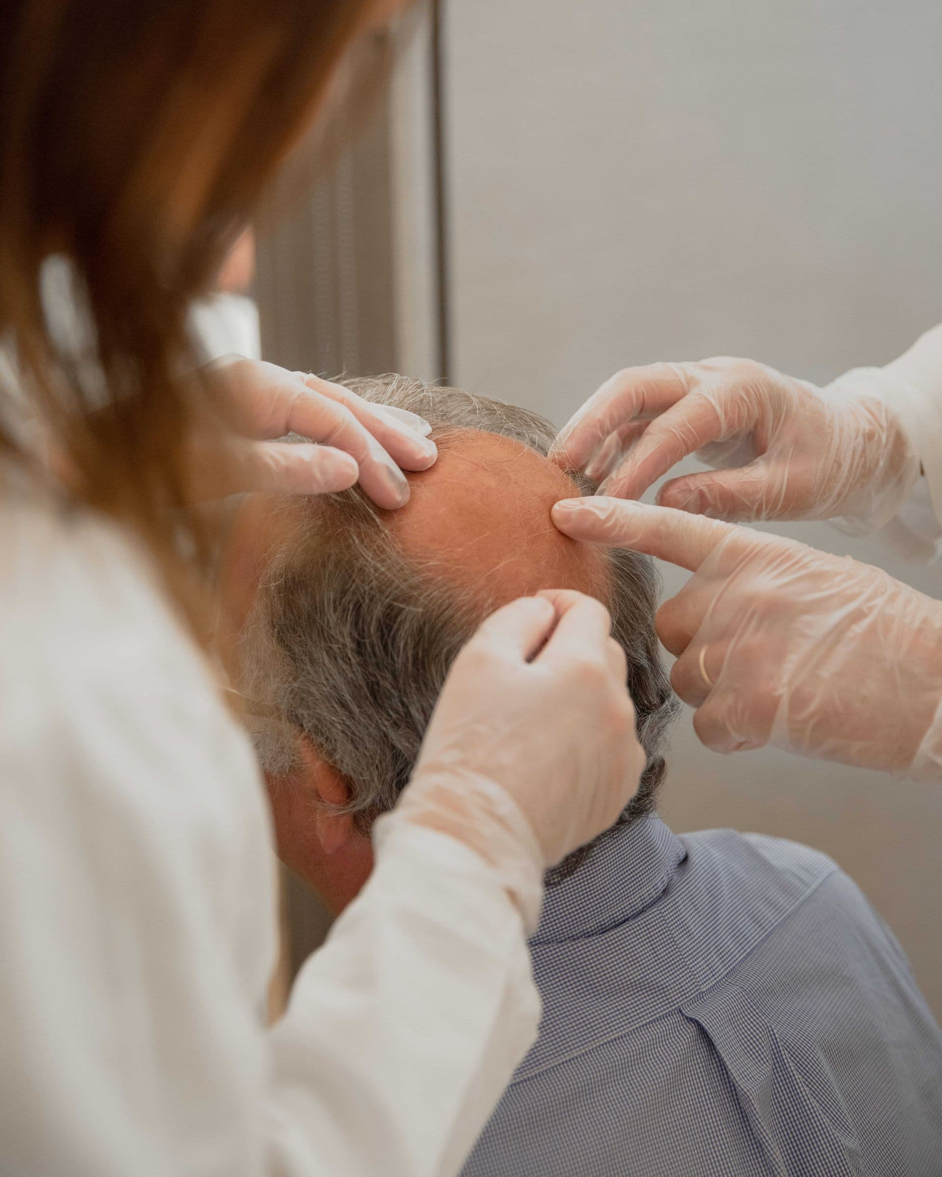 Cos'è l'Hair Filler e come funziona