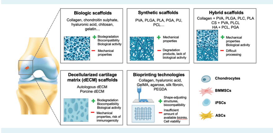 Key visual for tissue-engineering-and-future-directions-in-regenerative-medicine-for-knee-cartilage-repair-a-comprehensive-review