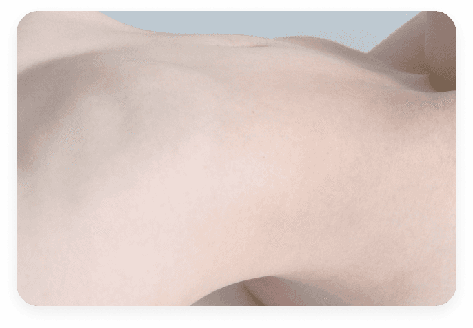 Bilanciamento Del Metabolismo