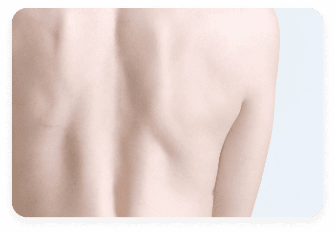 Muscle Tone Recovery