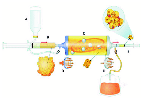 Key visual for chemical-profile-and-clinical-efficacy-of-micro-fragmented-adipose-tissue-in-the-treatment-of-knee-osteoarthritis