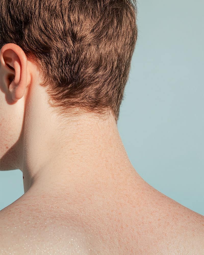 Perte de cheveux : causes, symptômes et remèdes