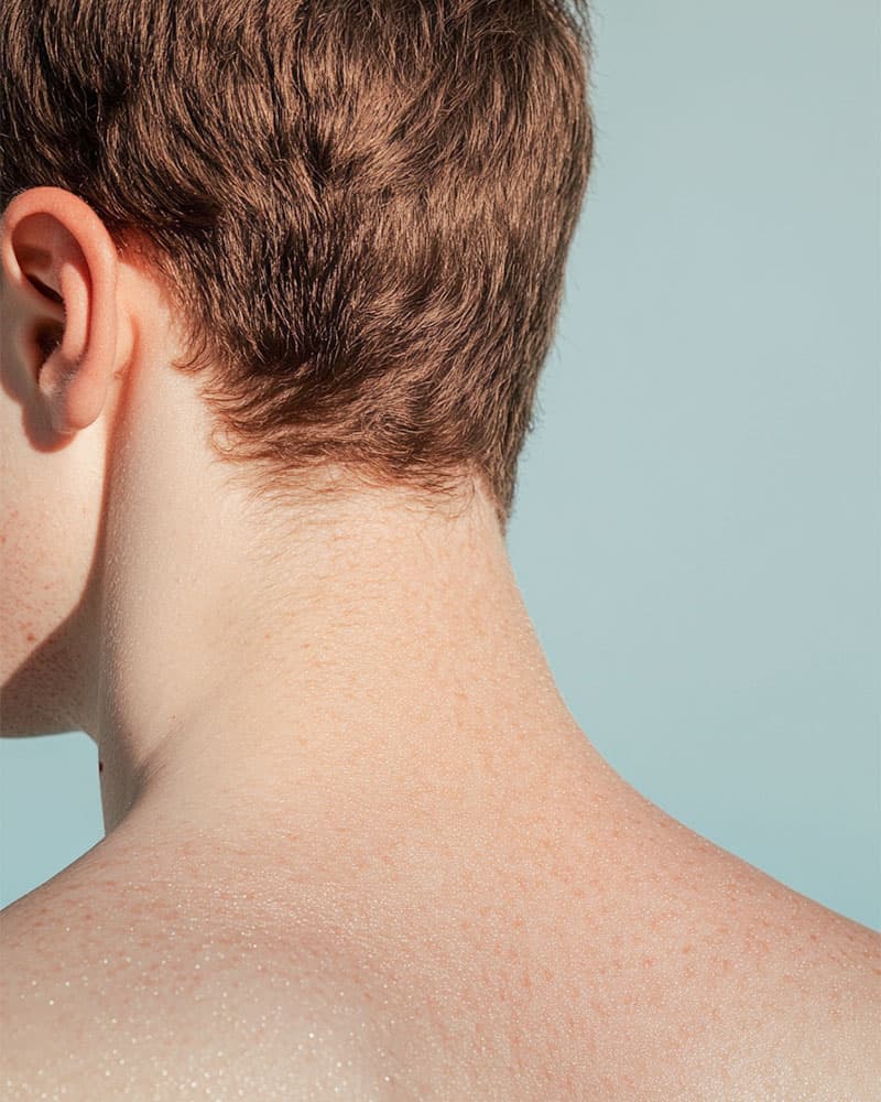 Regenerative Haartransplantation