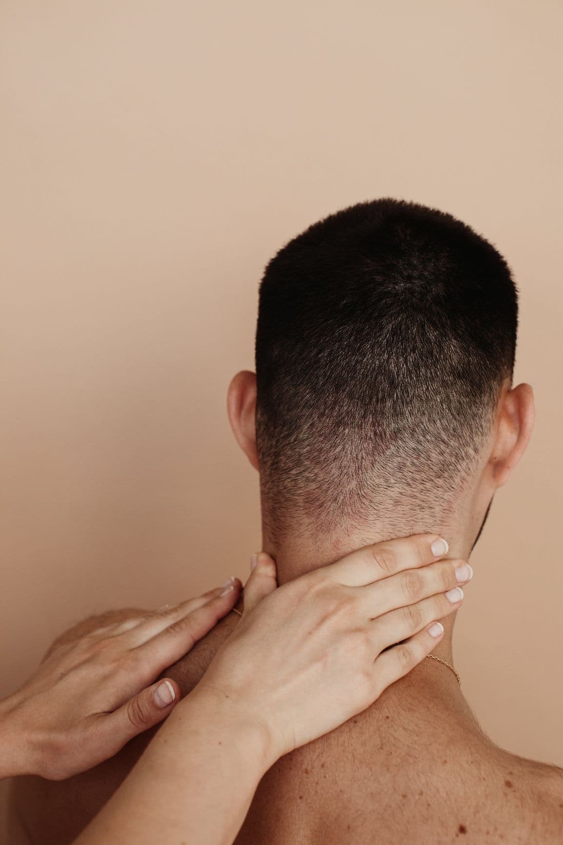 I benefici dell'Hair Filler per la caduta dei capelli