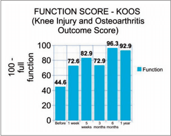 Key visual for non-responsive-knee-pain-with-osteoarthritis-and-concurrent-meniscal-disease-treated-with-autologous-micro-fragmented-adipose-tissue-under-continuous-ultrasound-guidance