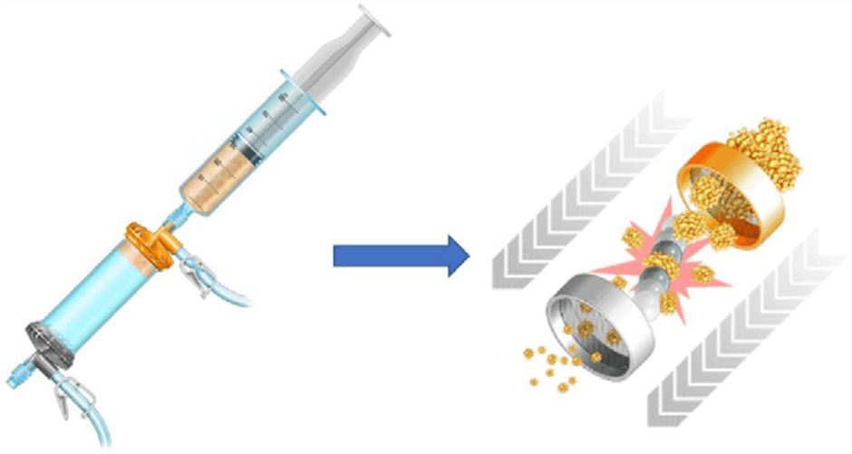 Key visual for open-wedge-high-tibial-osteotomy-associated-with-lipogems-intra-articular-injection-for-the-treatment-of-varus-knee-osteoarthritis-retrospective-study