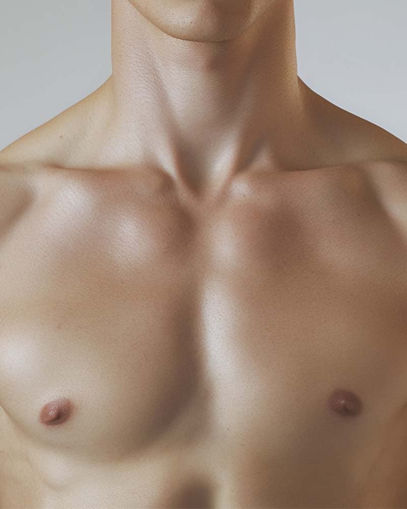 Gynecomastia and Male Breast Correction