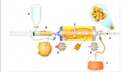 Key visual for mesenchymal-stromal-cells-and-micro-fragmented-adipose-tissue-new-horizons-of-effectiveness-of-lipogems