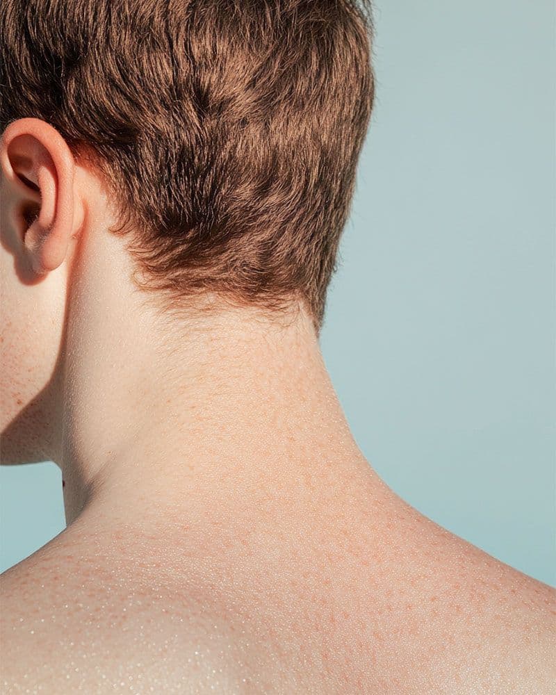 Otoplasty: How to Correct Protruding Ears?