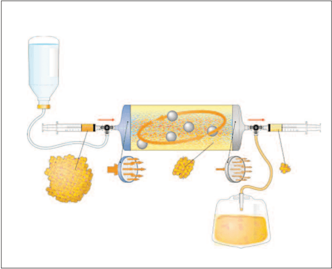 Key visual for micro-fractured-and-purified-adipose-tissue-graft-lipogems-can-improve-the-orthognathic-surgery-outcomes-both-aesthetically-and-in-postoperative-healing