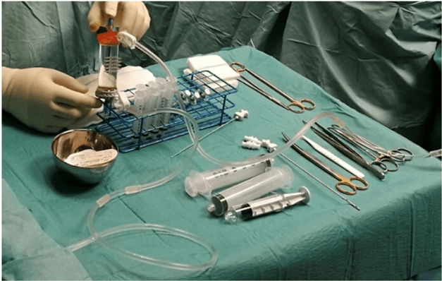 Key visual for il-trattamento-delle-condropatie-degenerative-con-tessuto-adiposo-autologo-microframmentato