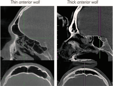 Key visual for evolution-of-full-facial-feminization-surgery-creating-the-gendered-face-with-an-all-in-one-procedure