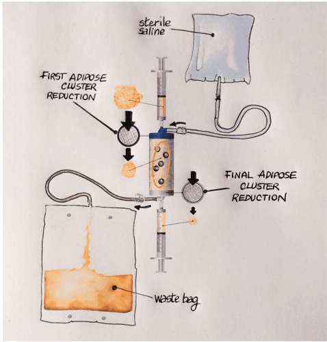 Key visual for adipose-tissue-and-mesenchymal-stem-cells-state-of-the-art-and-lipogems-technology-development