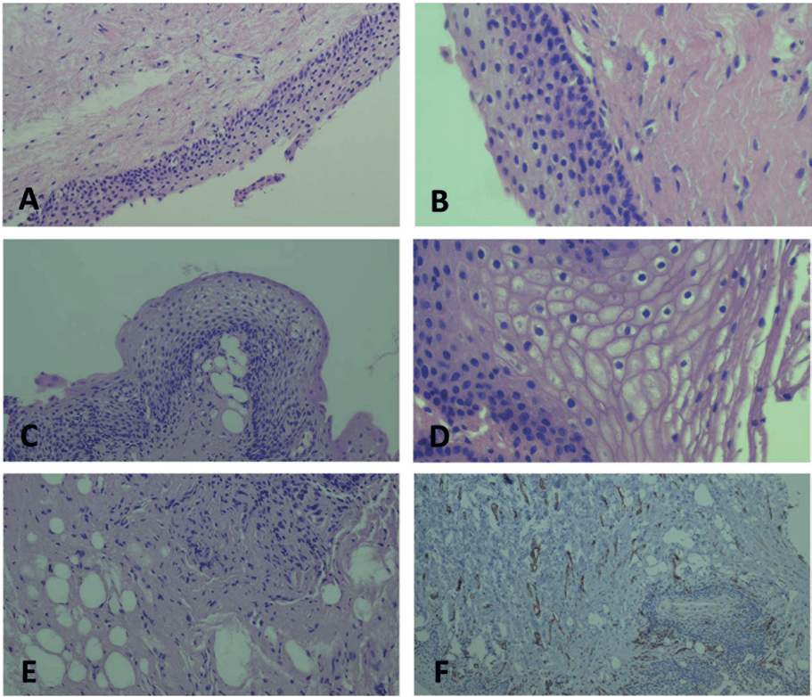 Key visual for menopause-new-frontiers-in-the-treatment-of-urogenital-atrophy