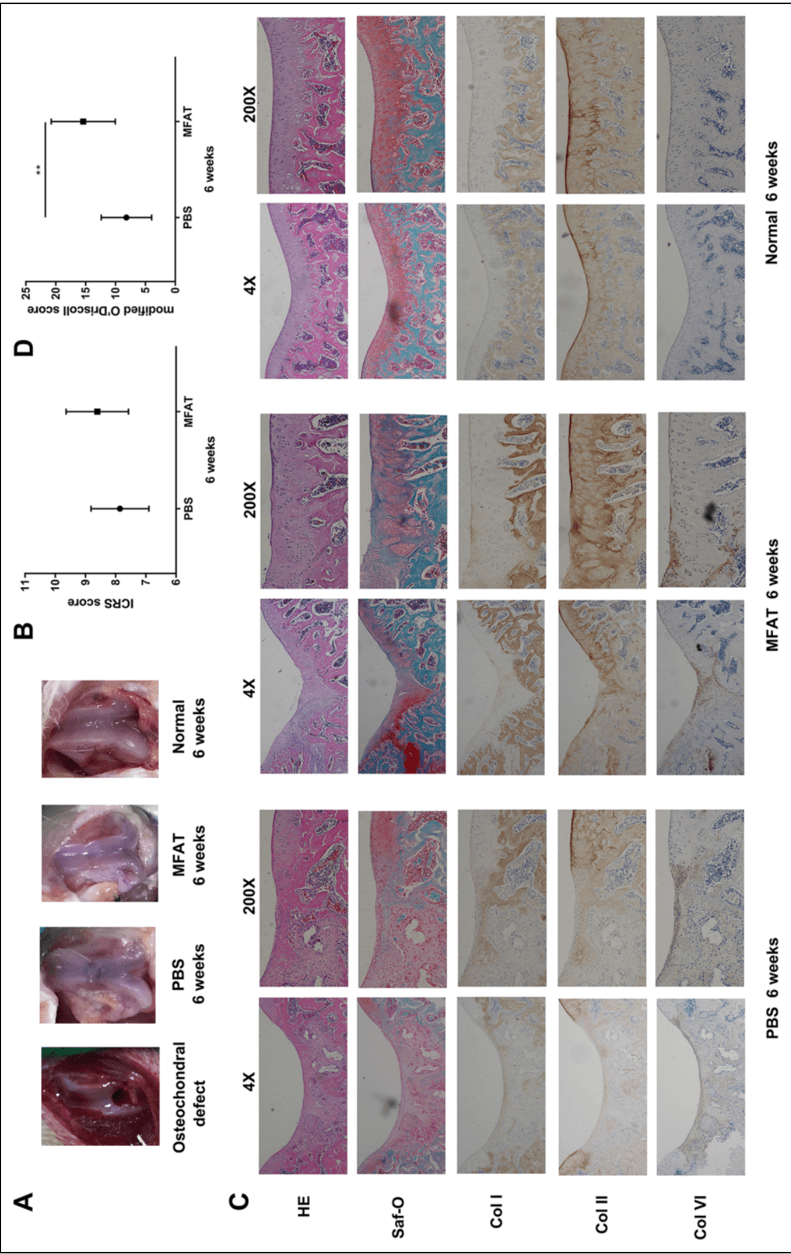 Key visual for autologous-micro-fragmented-adipose-tissue-as-stem-cell-based-natural-scaffold-for-cartilage-defect-repair