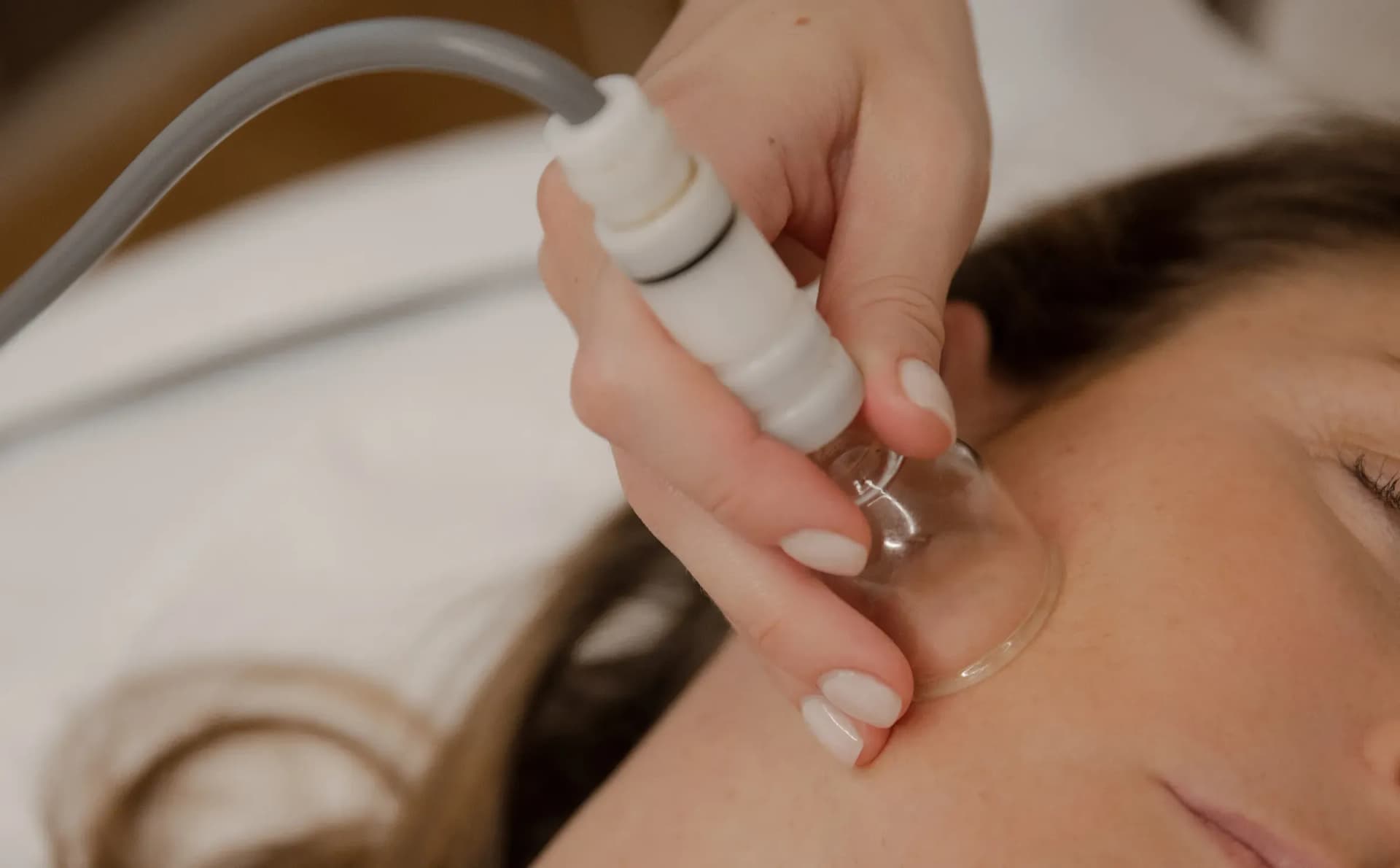 a-cosa-serve-la-coppettazione image milano