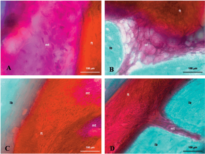 Key visual for benzi-2015