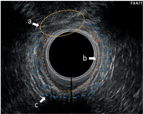 Key visual for giori-2015