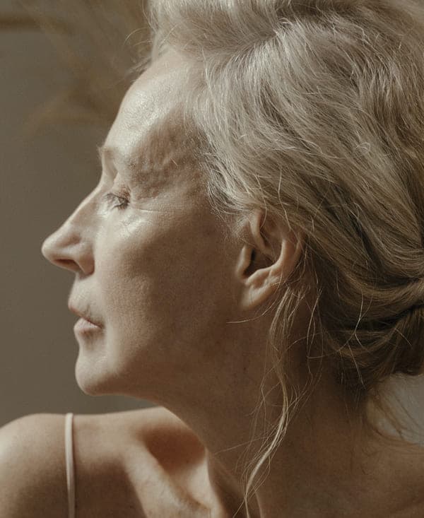 Wrinkle Reduction and Prevention