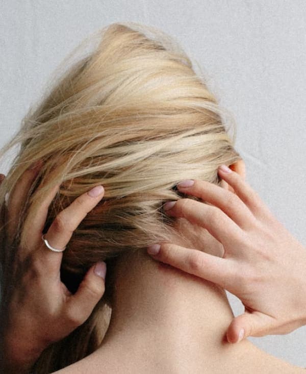 Alopezie