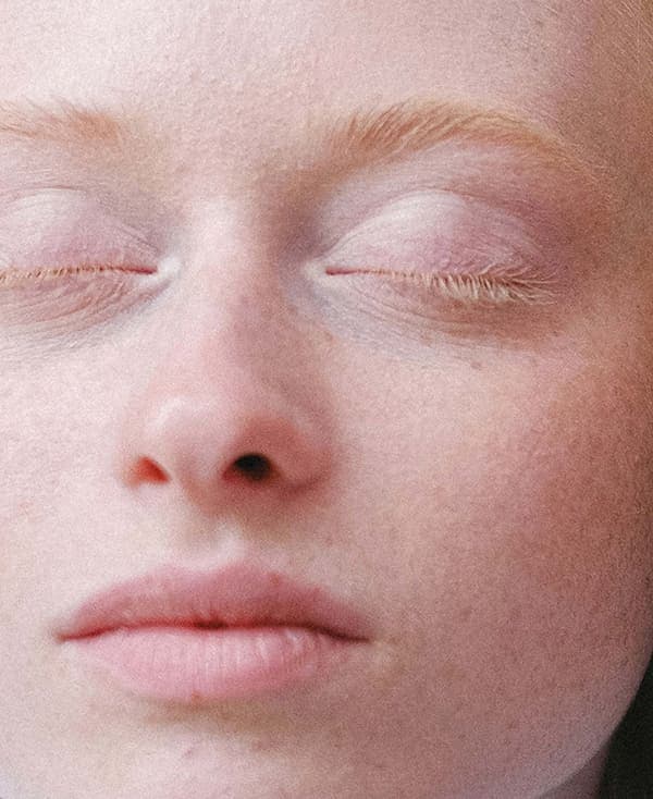 Facial Asymmetry