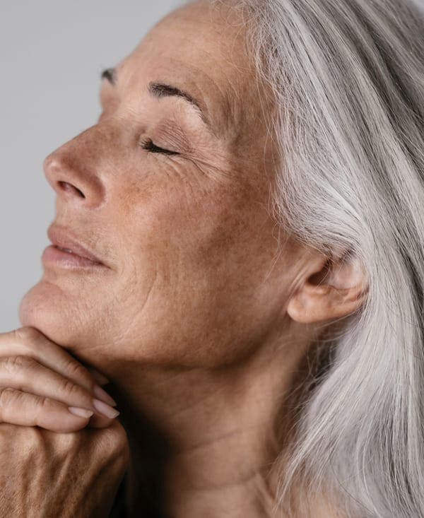 Skin Spots, Solar Lentigo