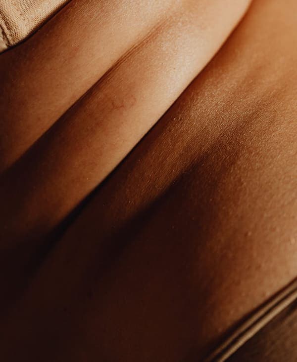 Localized Fat Deposits