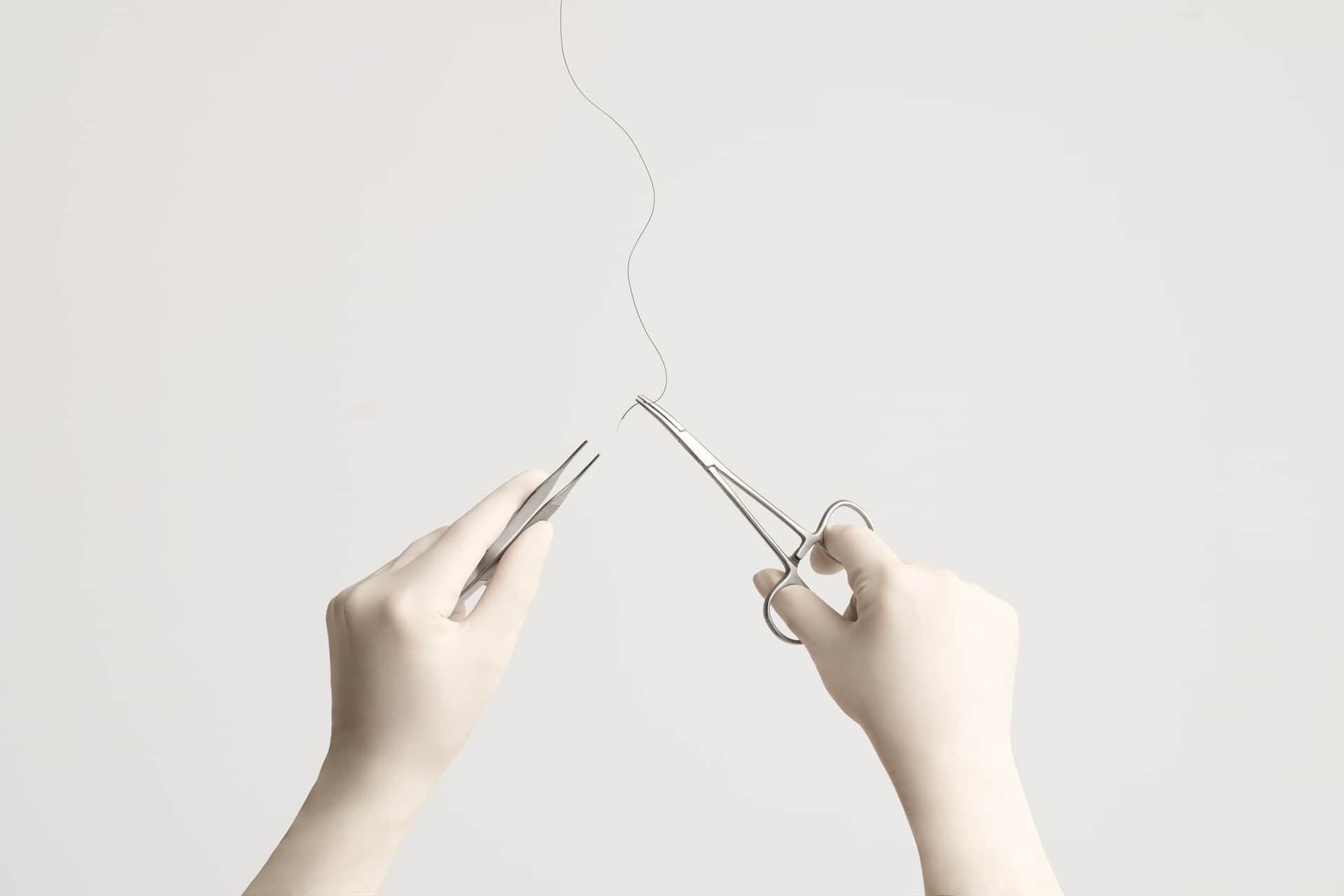 Lifting du visage avant et après : à quoi s'attendre ? Qu'est-ce que c'est et comment ça fonctionne