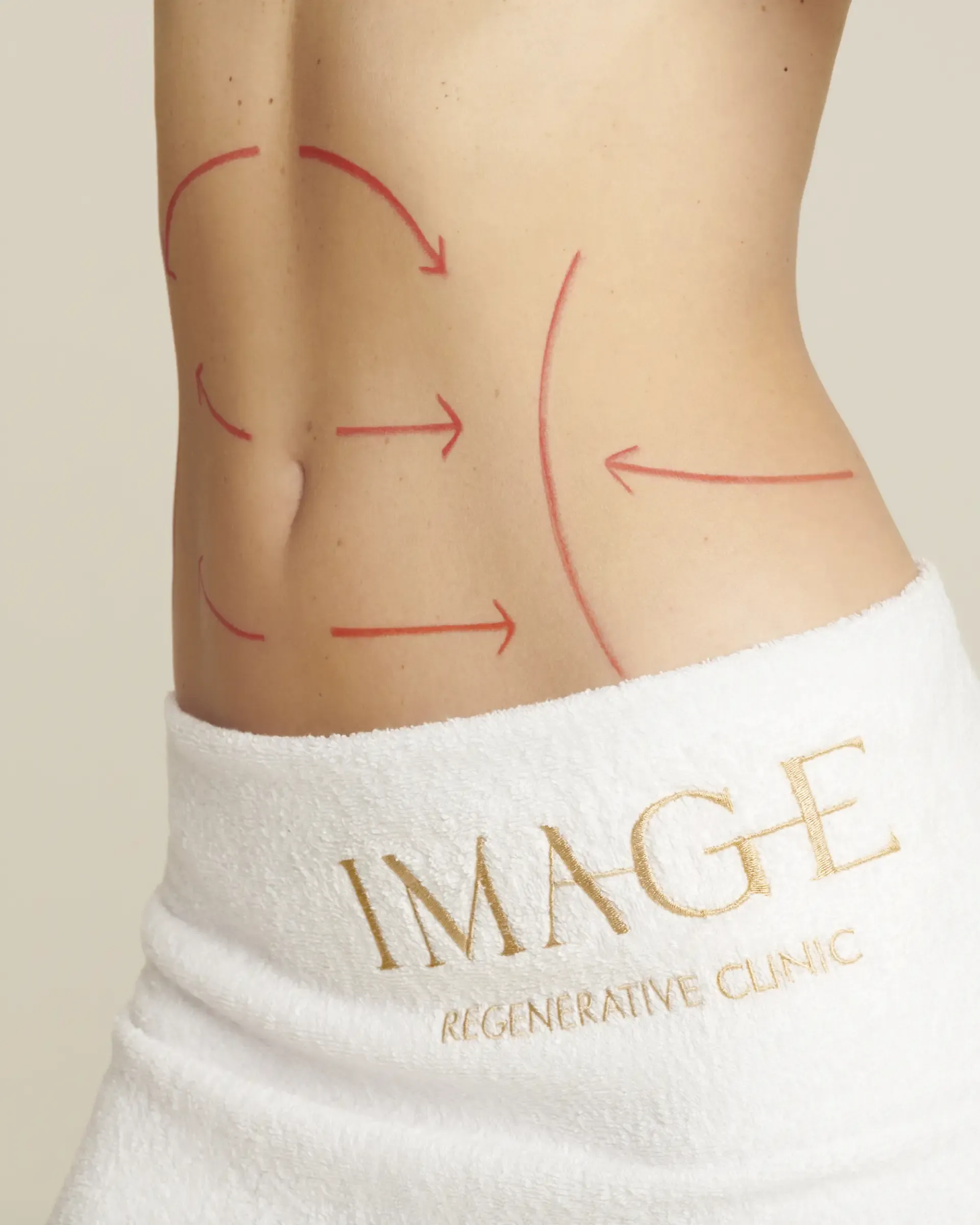 Liposuzione addome: come togliere il grasso dalla pancia?