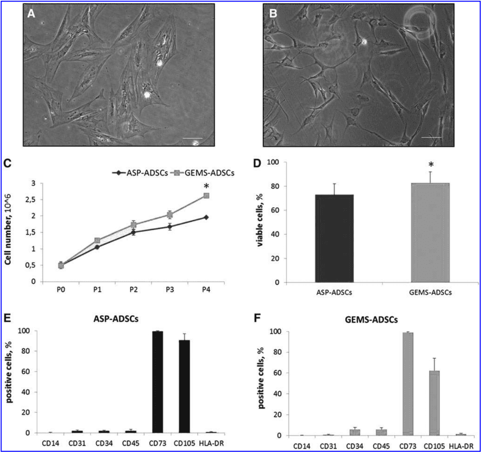 Key visual for the-adipose-mesenchymal-stem-cell-secretome-inhibits-inflammatory-responses-of-microglia-evidence-for-an-involvement-of-sphingosine-1-phosphate-signalling