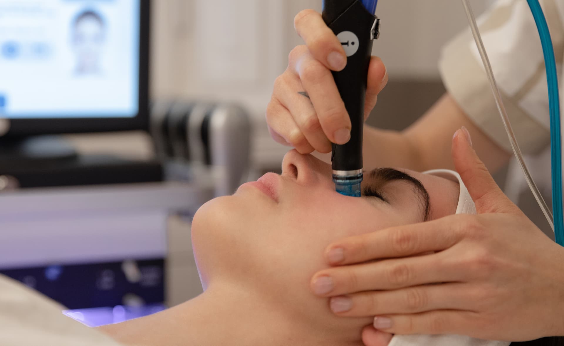 prima-e-dopo-hydrafacial