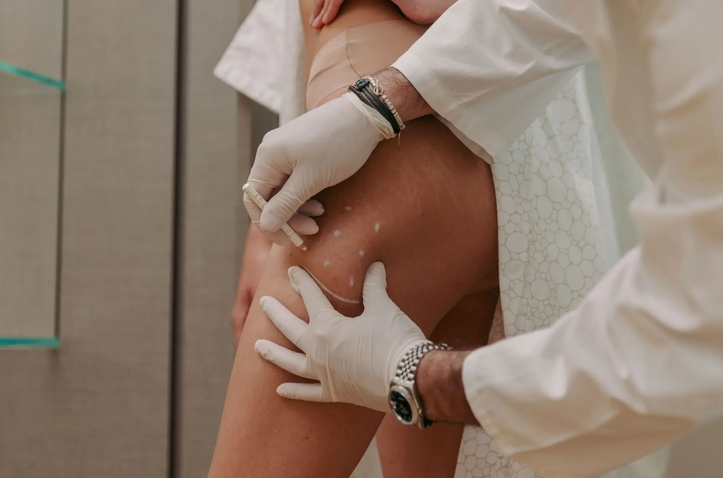 Gambe Gonfie: come ridurre l'infiammazione? Consigli e Protocolli