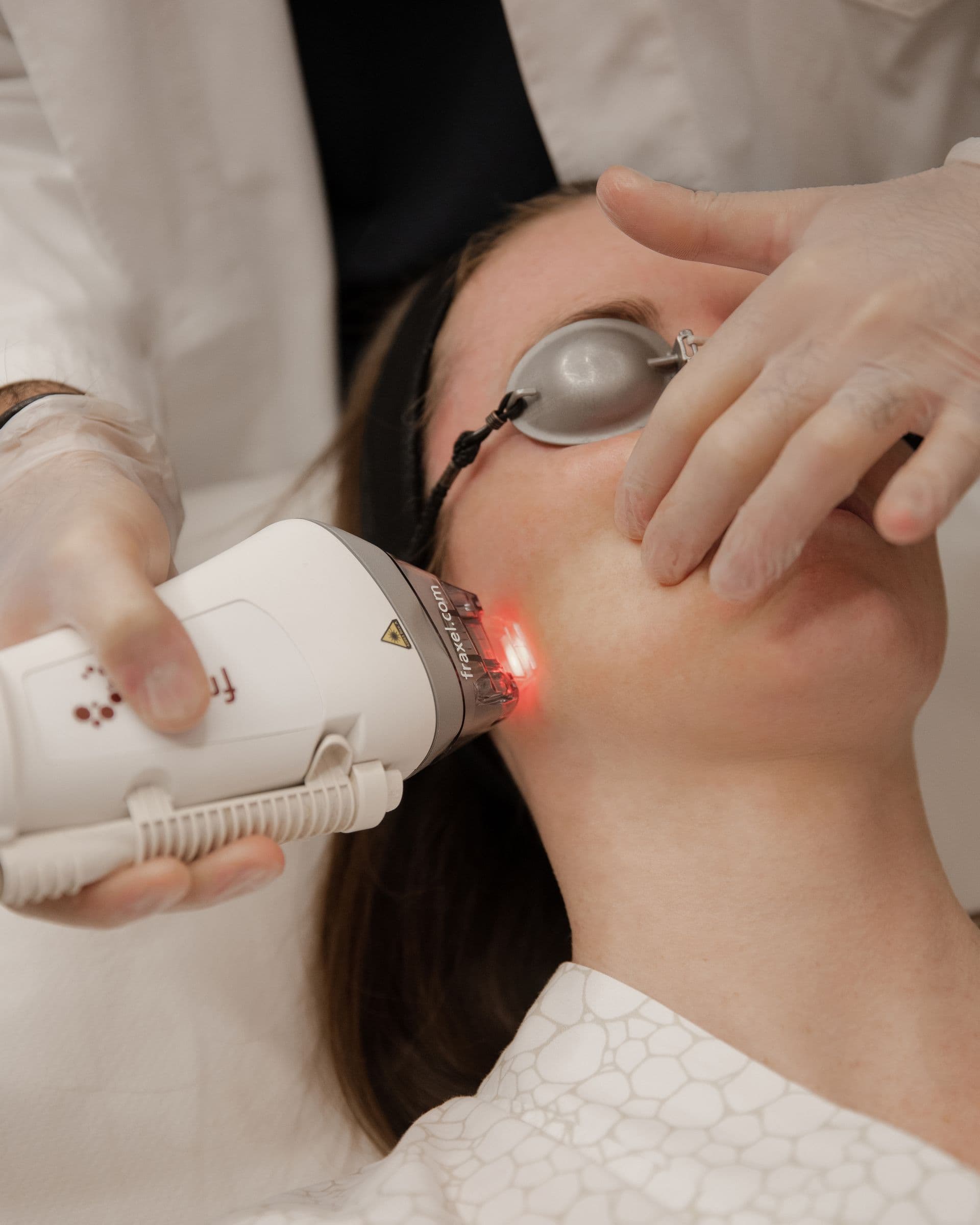 Gesichtsflecken nach Laser: Wie entfernt man sie mit der ästhetischen Behandlung?