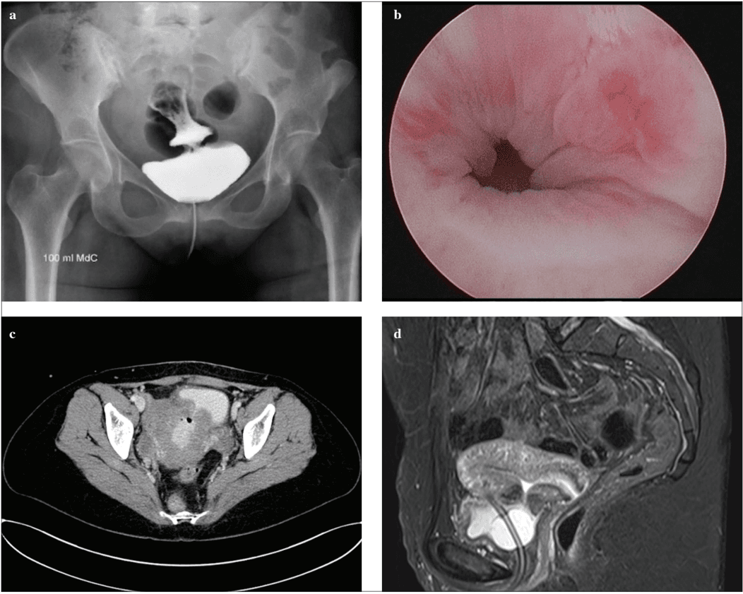 Key visual for spinelli-2020