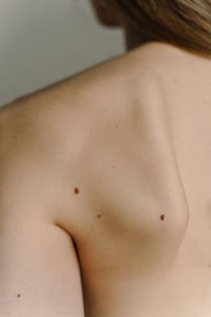 Visita Dermatologica