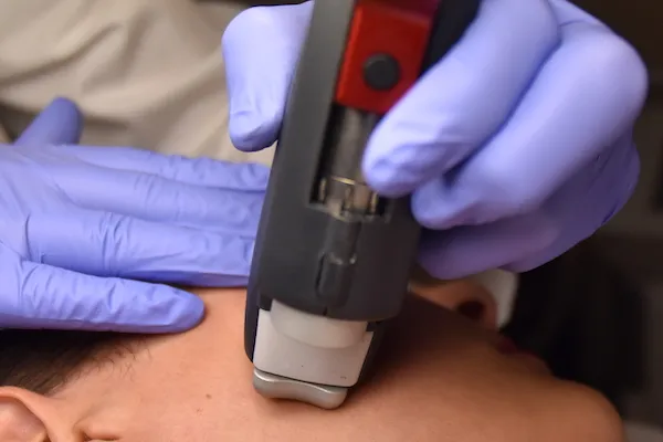 Autunno, tempo di Laser