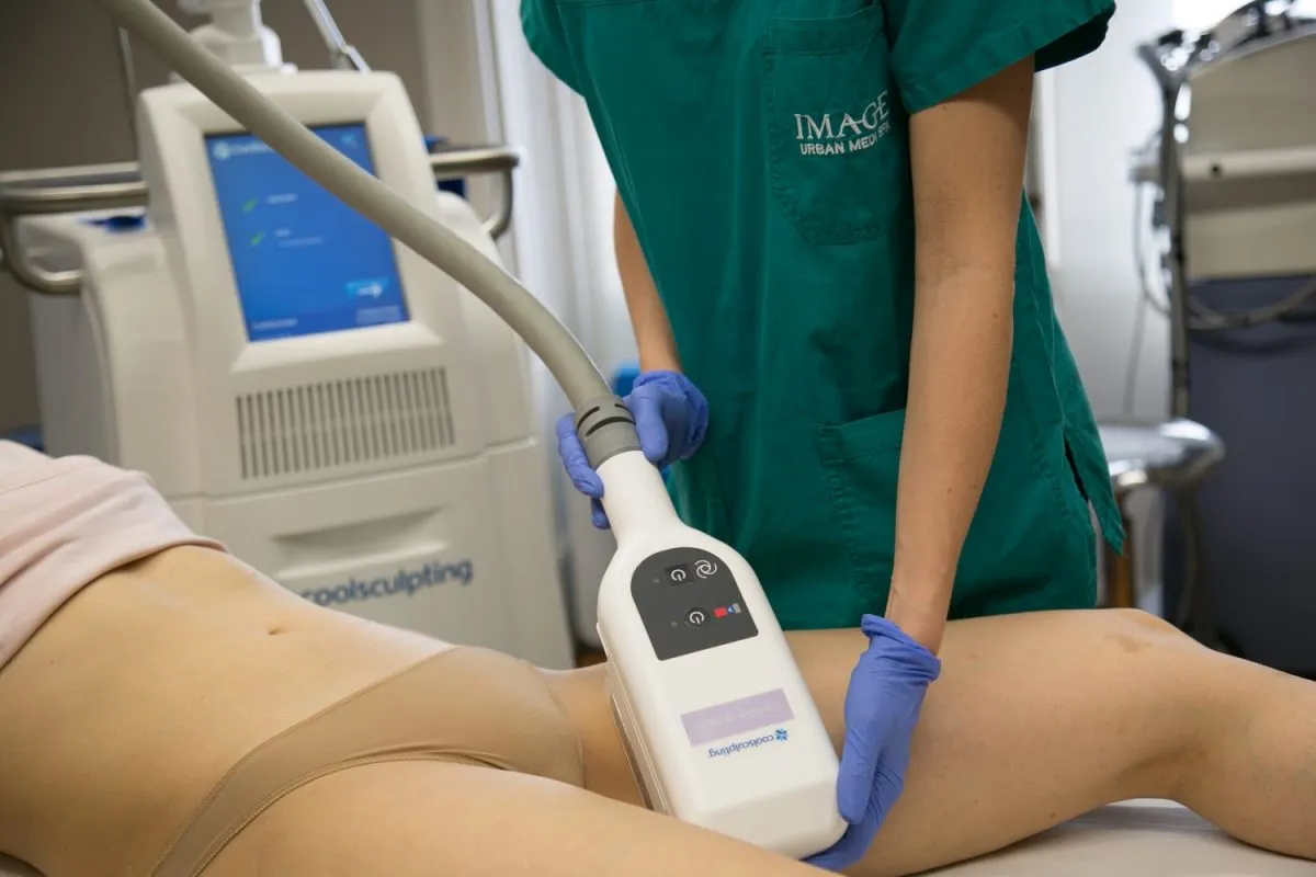 CoolSculpting: The Cold That Reshapes Your Body
