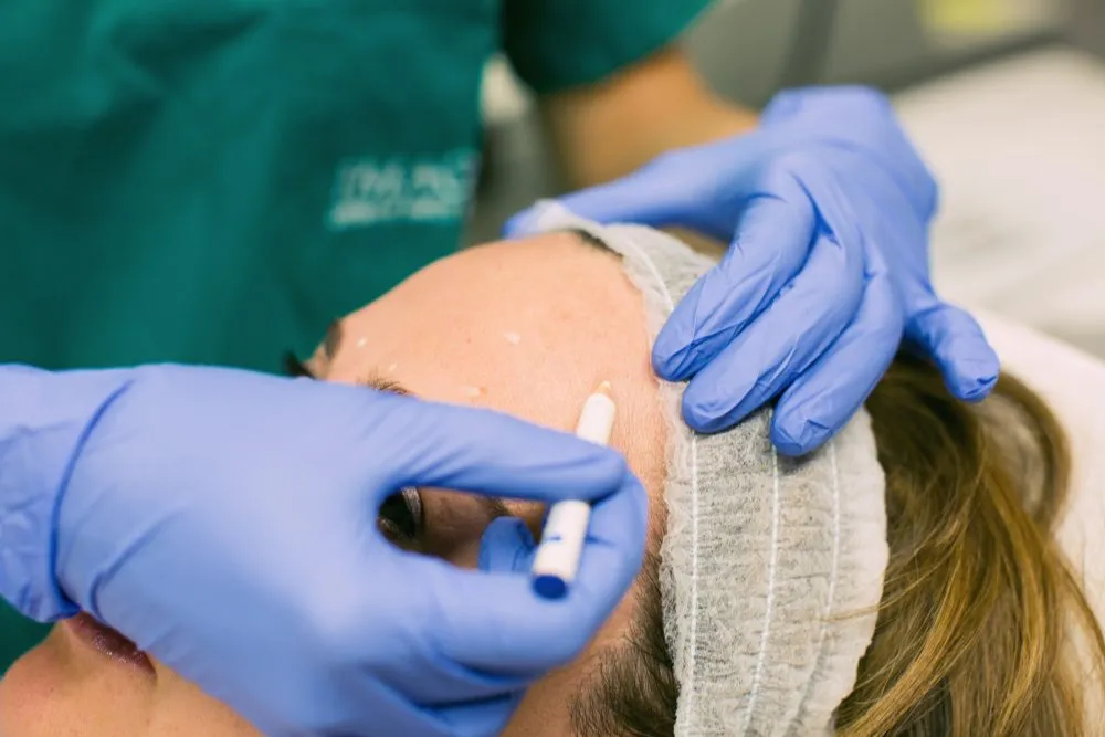 Rajeunissement Global du Visage : L'Approche Full Face