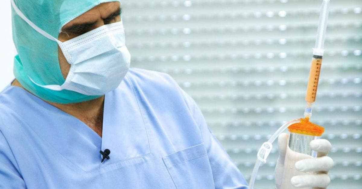 Lipogems: Tausende orthopädische Patienten können von der FDA-zugelassenen Technologie profitieren, die ihr eigenes Körperfett nutzt