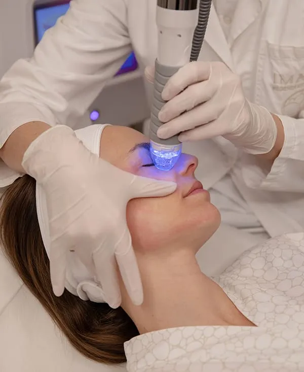 Pores dilatés ? Guide rapide des traitements laser