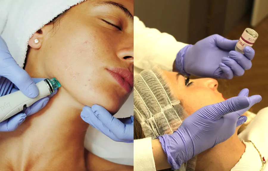 Which Treatments to Do (and Which to Avoid) After Summer Vacation