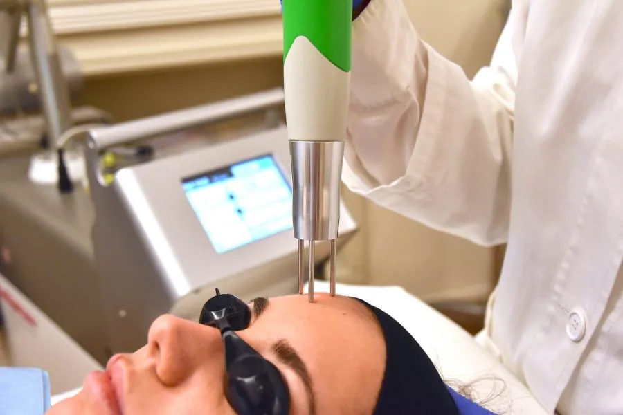 Entfernung von Hautpigmentierung mit Q-Switched Laser