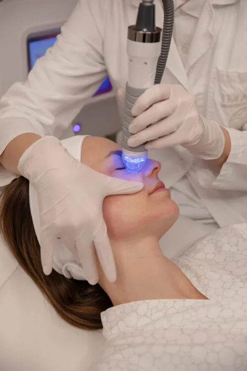 Vivace: Radiofrequency with Regenerative Microneedles