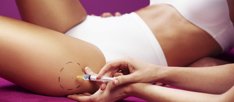 Cellulite? Zeit, Ihre Beine zu zeigen